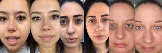 RevitalEyes Before and After: My Honest Results and Regrets