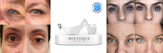 Jelly Roll Botox Ruined My Eyes Here’s What Actually Worked to Fix Them