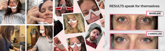 How Often Should You Use Red Light Therapy for Under Eyes?