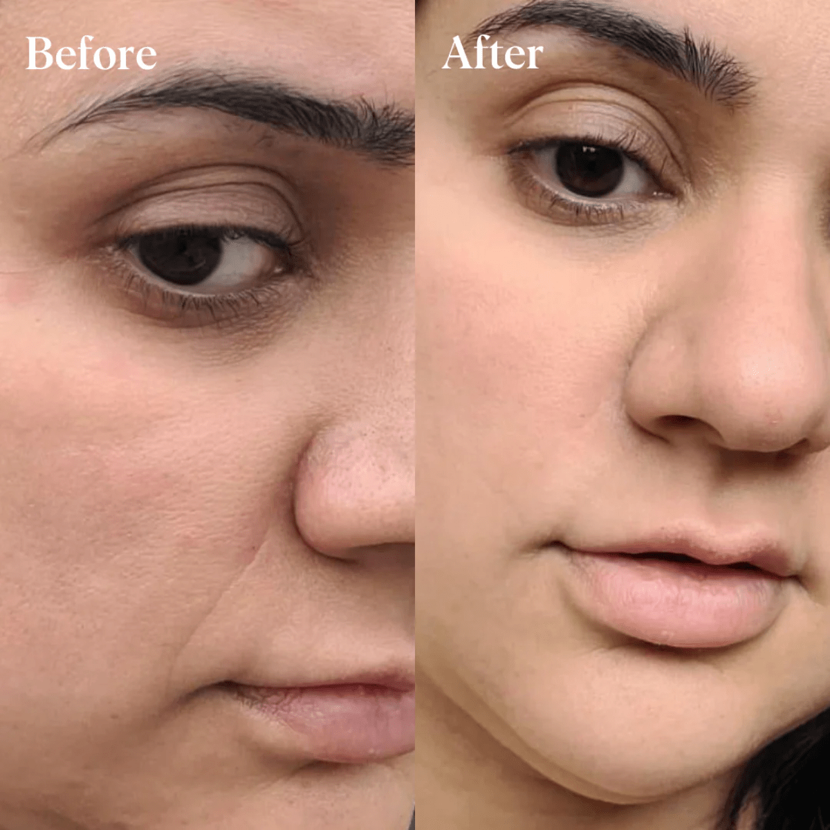 DeepCare+™ Microfusion Repair Patches - Botanique Paris