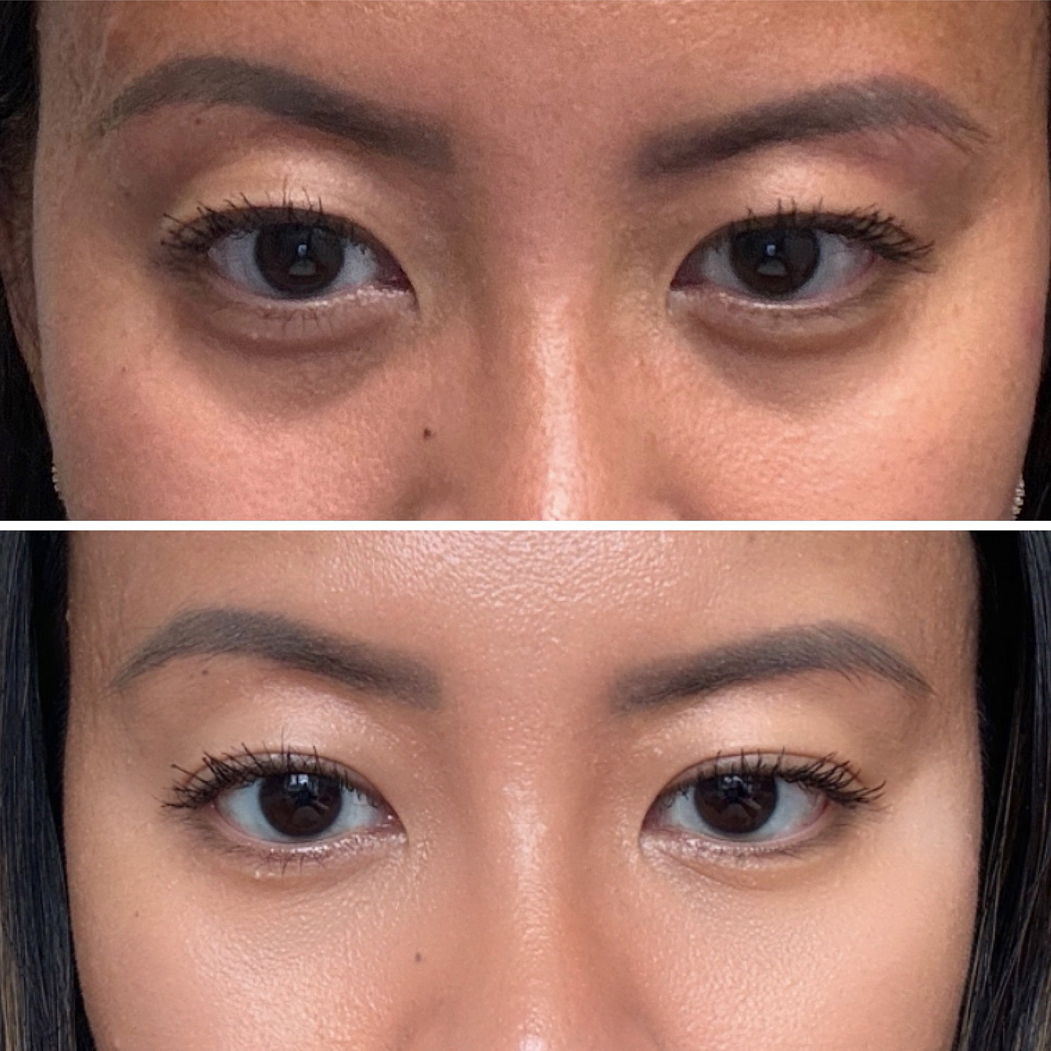 Niacinamide Botanique Paris before and after comparison