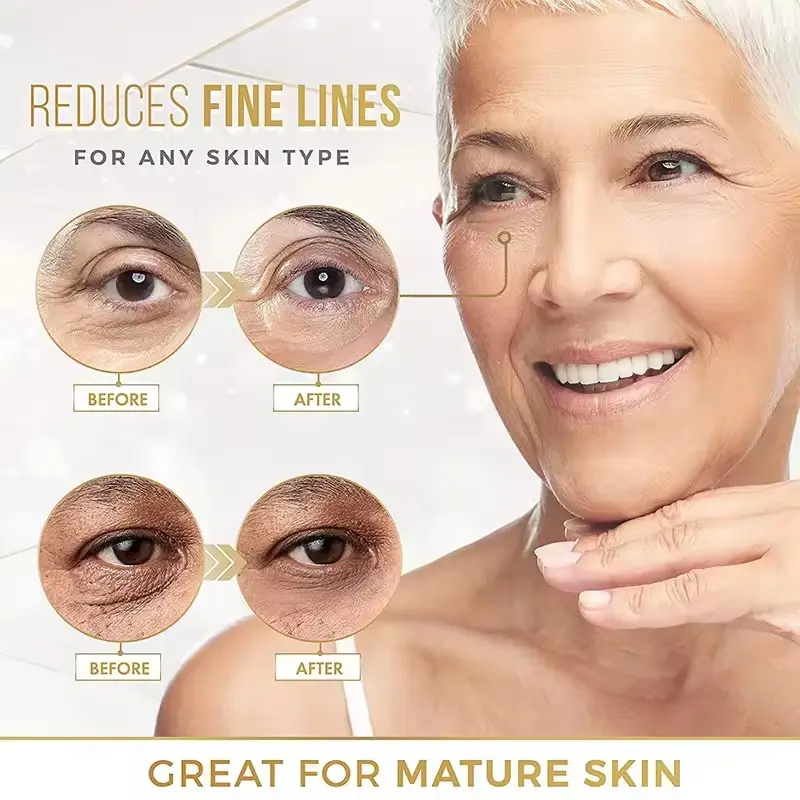 Face Lines