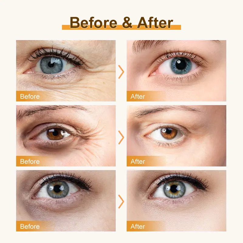 Before and After