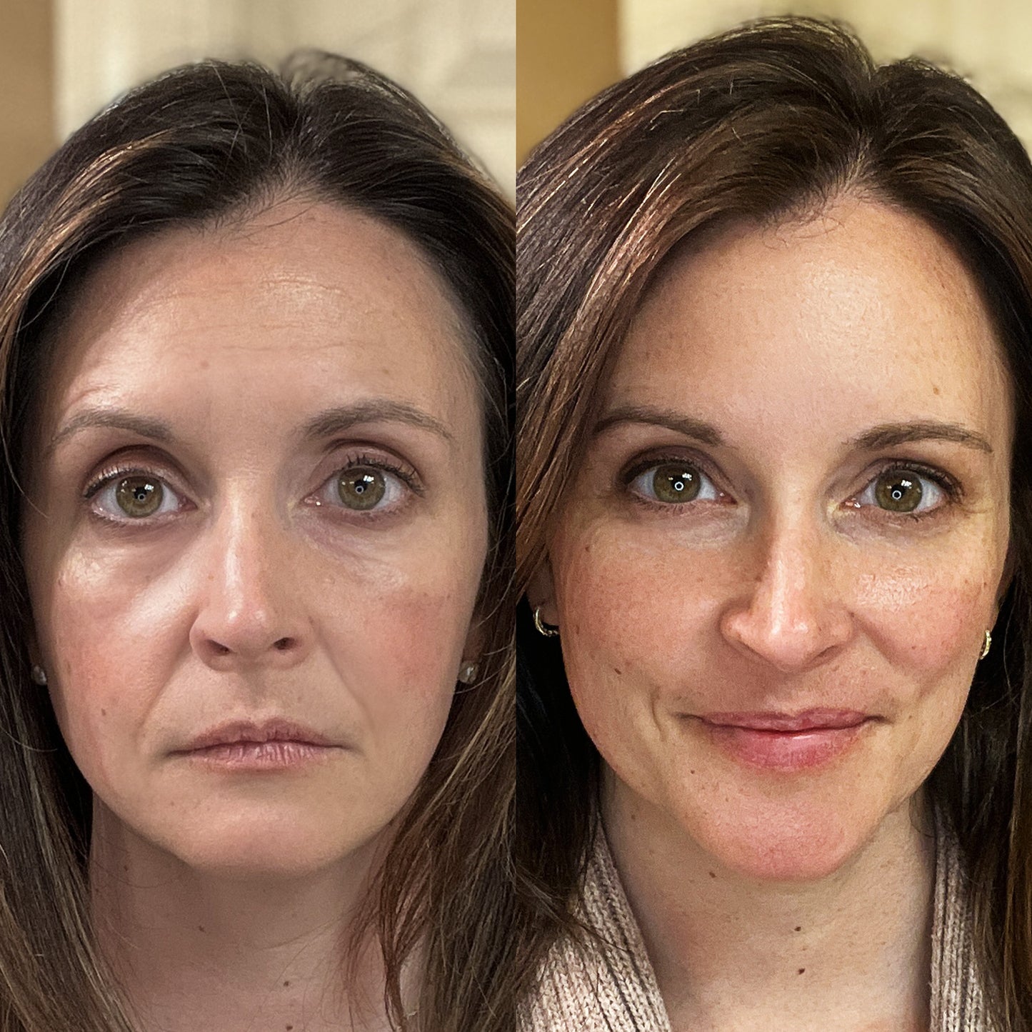 Therapy Face Mask