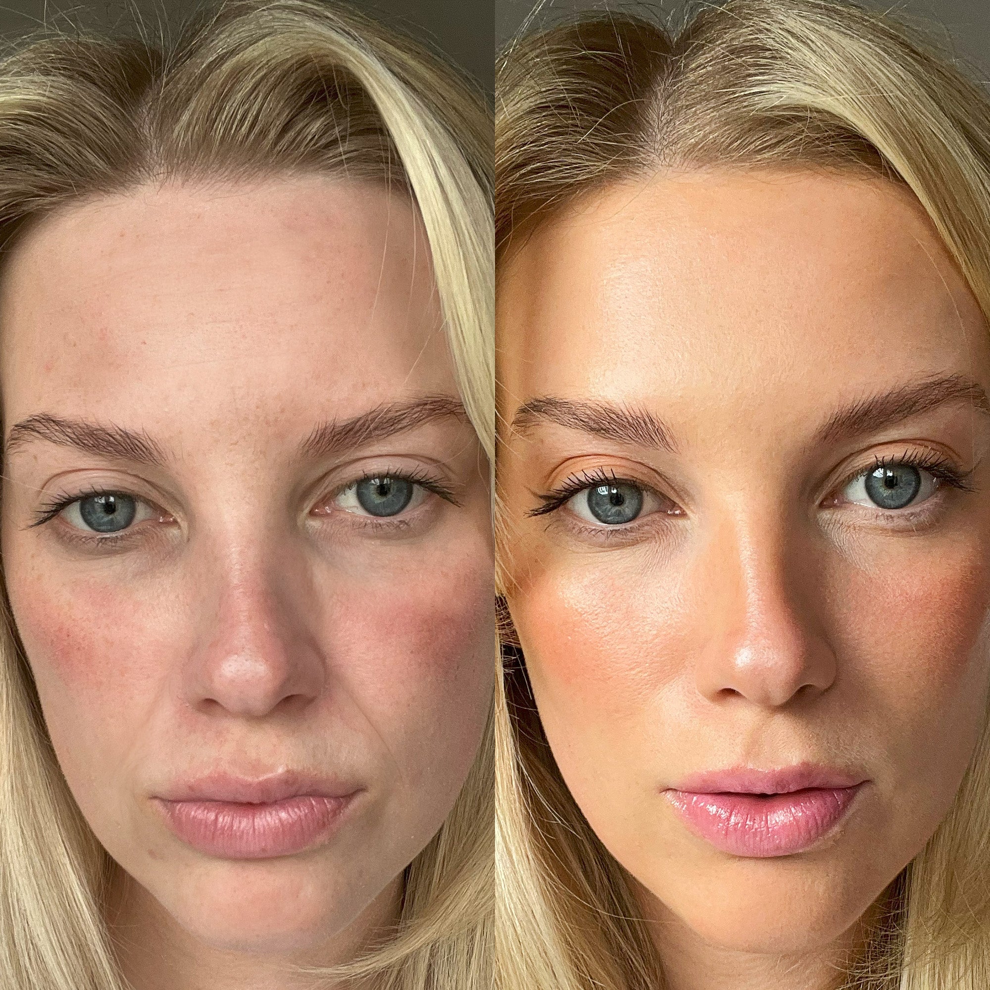 investing in my skin's future