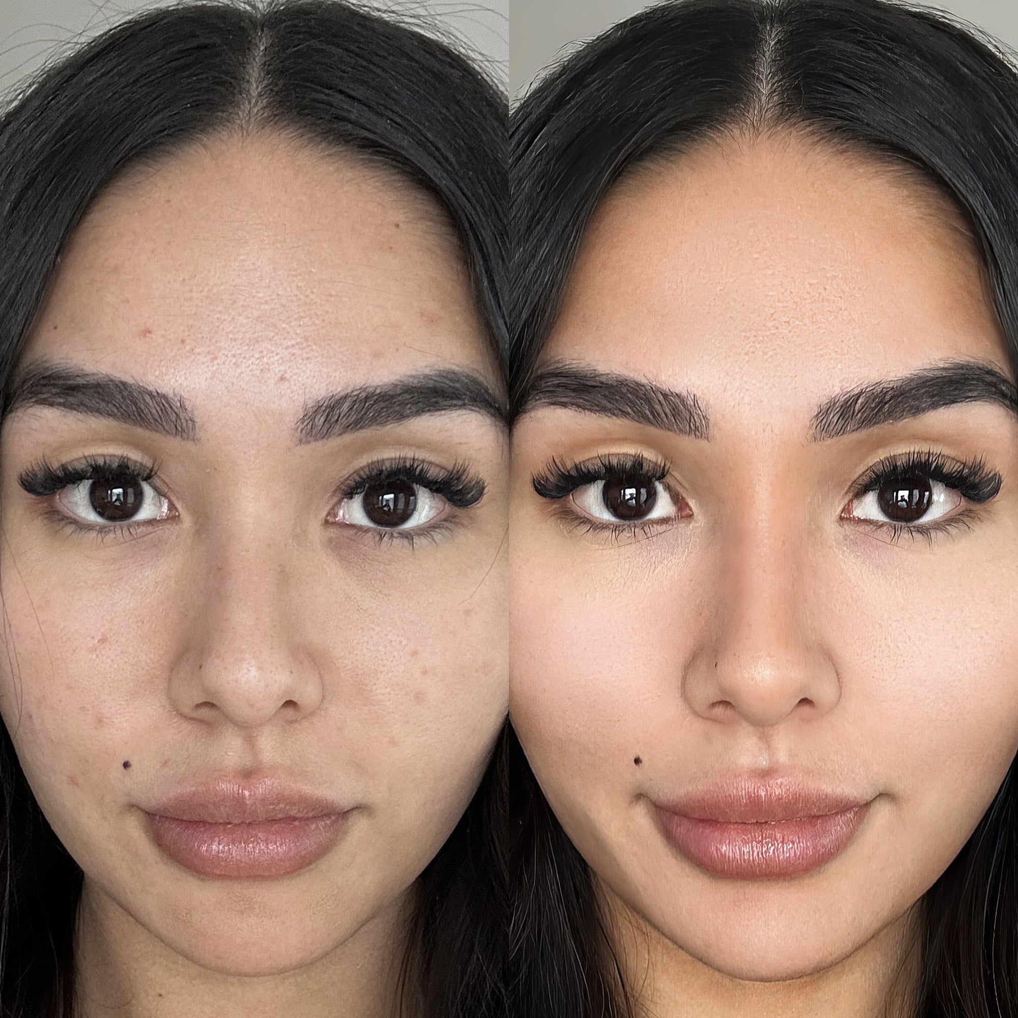 the skin rejuvenation