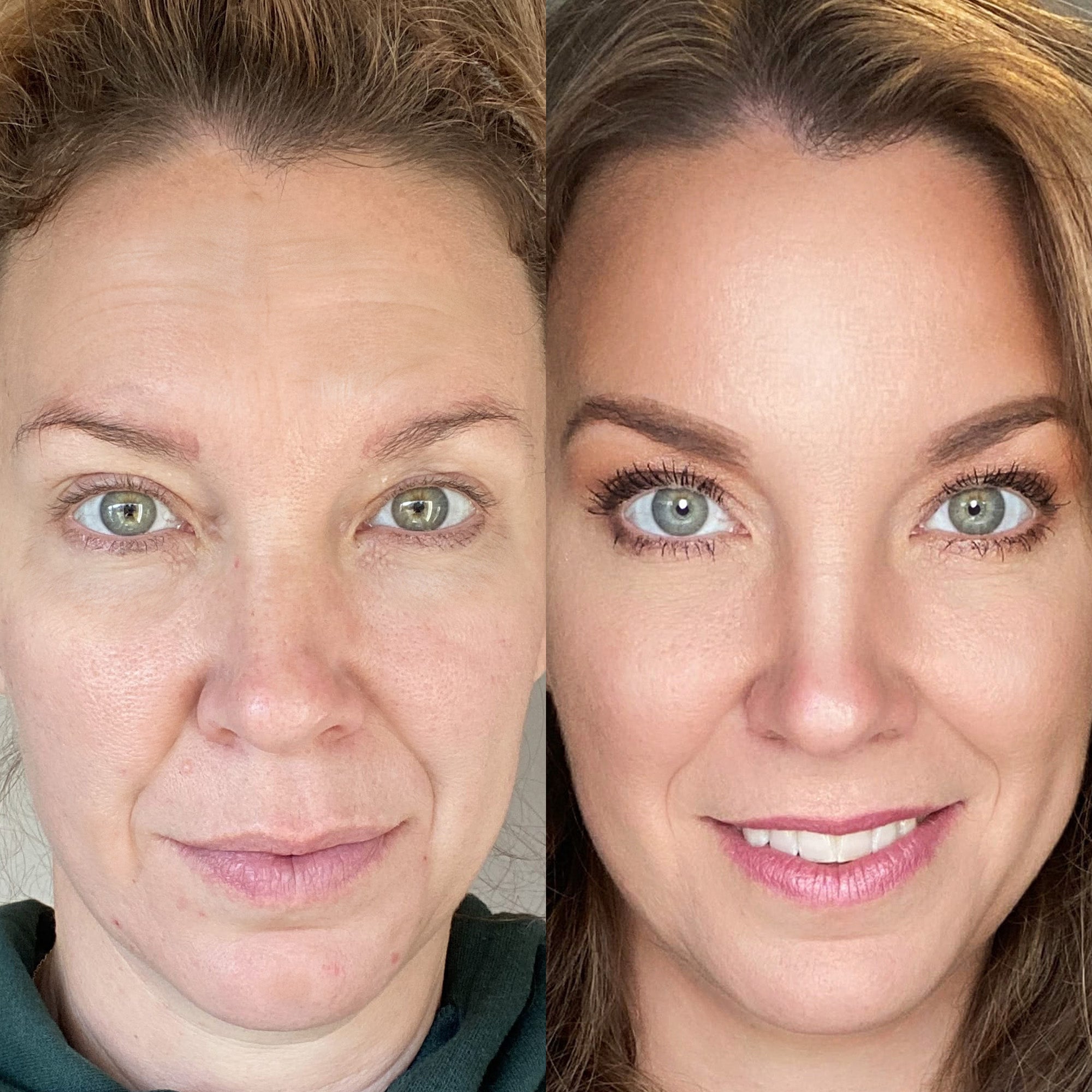 Multi - Spectral Chin & Neck Tightening Light Therapy® Device - Botanique Paris