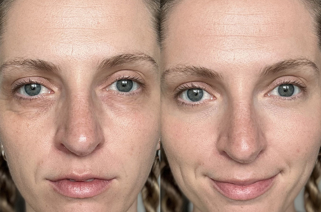 Safe and Non-Invasive Treatment