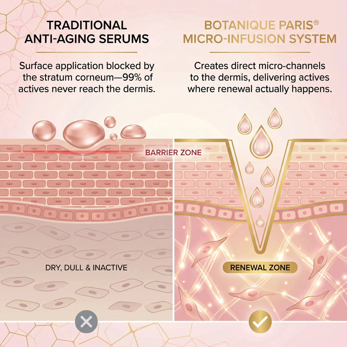 Creams stay on the surface; micro-infusion reaches deeper