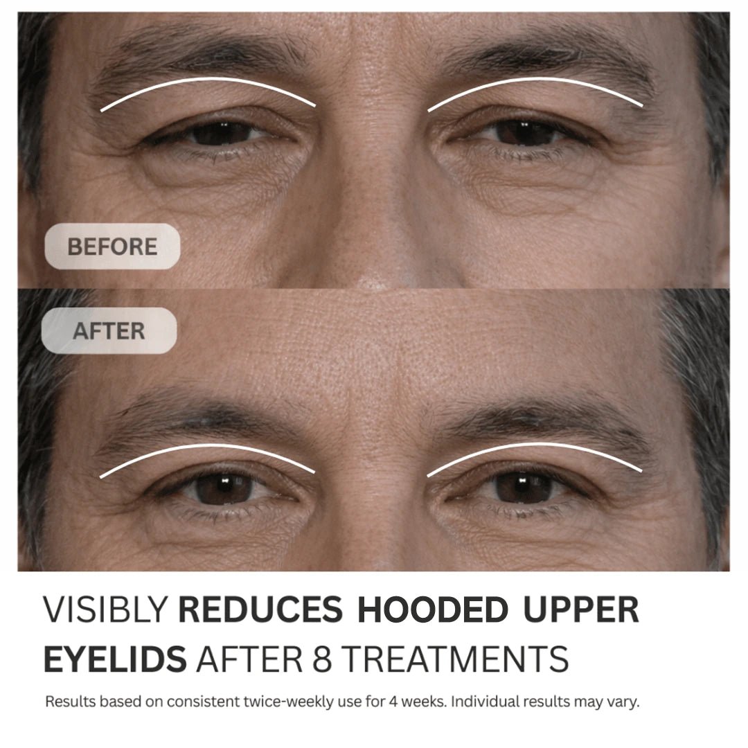 Multi-Peptide Micro-Infusion System 2.0 for Hooded Eyes | Botanique Paris Multi-Peptide Micro-Infusion System 2.0 for Hooded Eyes | Botanique Paris