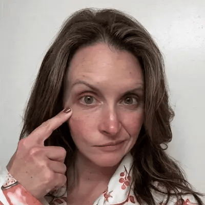 effect of treatment on eyes