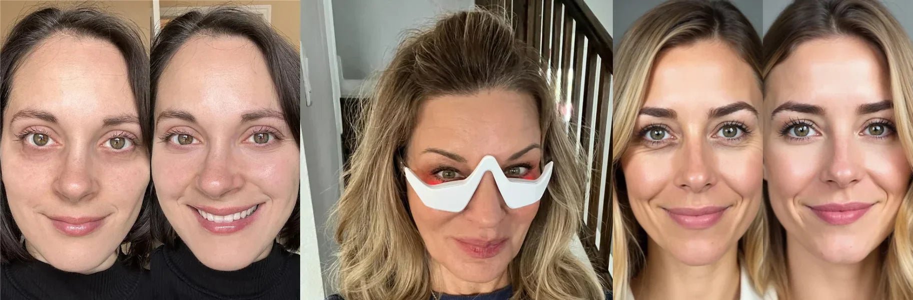 Non‑Invasive Eye Rejuvenation That Actually Delivers | RevitalEyes ...