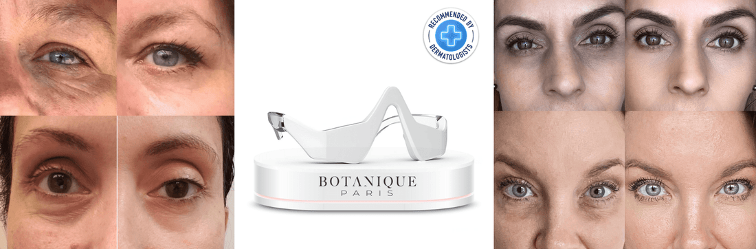 Jelly Roll Botox Ruined My Eyes Here’s What Actually Worked to Fix Them - Botanique Paris
