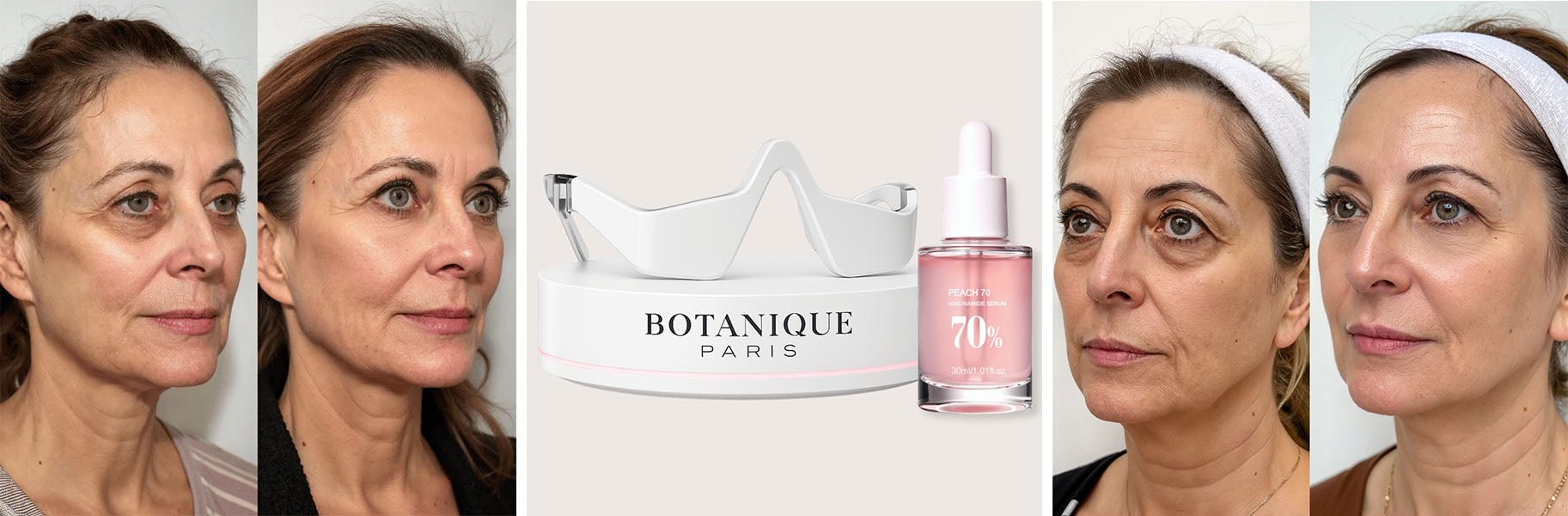 The Skin Rejuvenation Device That’s Replacing Botox for Eye Bags - Botanique Paris