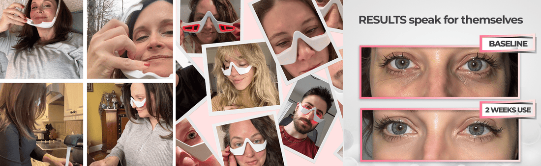 How Often Should You Use Red Light Therapy for Under Eyes? - Botanique Paris