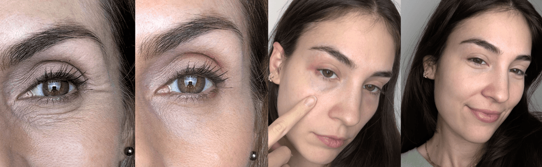 Is Red Light Therapy Safe During Pregnancy? - Botanique Paris