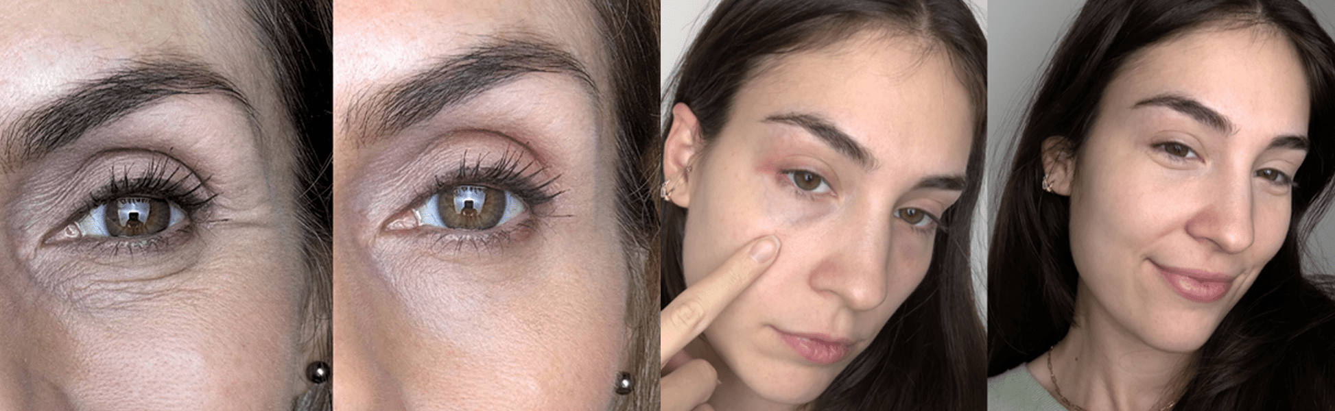 Is Red Light Therapy Safe During Pregnancy? - Botanique Paris