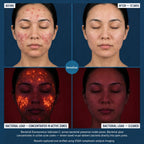 DermaClear™ Face Towels For Acne-Prone Skin - Botanique Paris