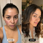 DermaClear™ Face Towels For Acne-Prone Skin - Botanique Paris