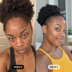 DermaClear™ Face Towels For Acne-Prone Skin - Botanique Paris