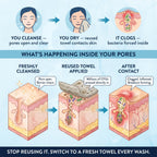 DermaClear™ Face Towels For Acne-Prone Skin - Botanique Paris