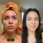 DermaClear™ Face Towels For Acne-Prone Skin - Botanique Paris