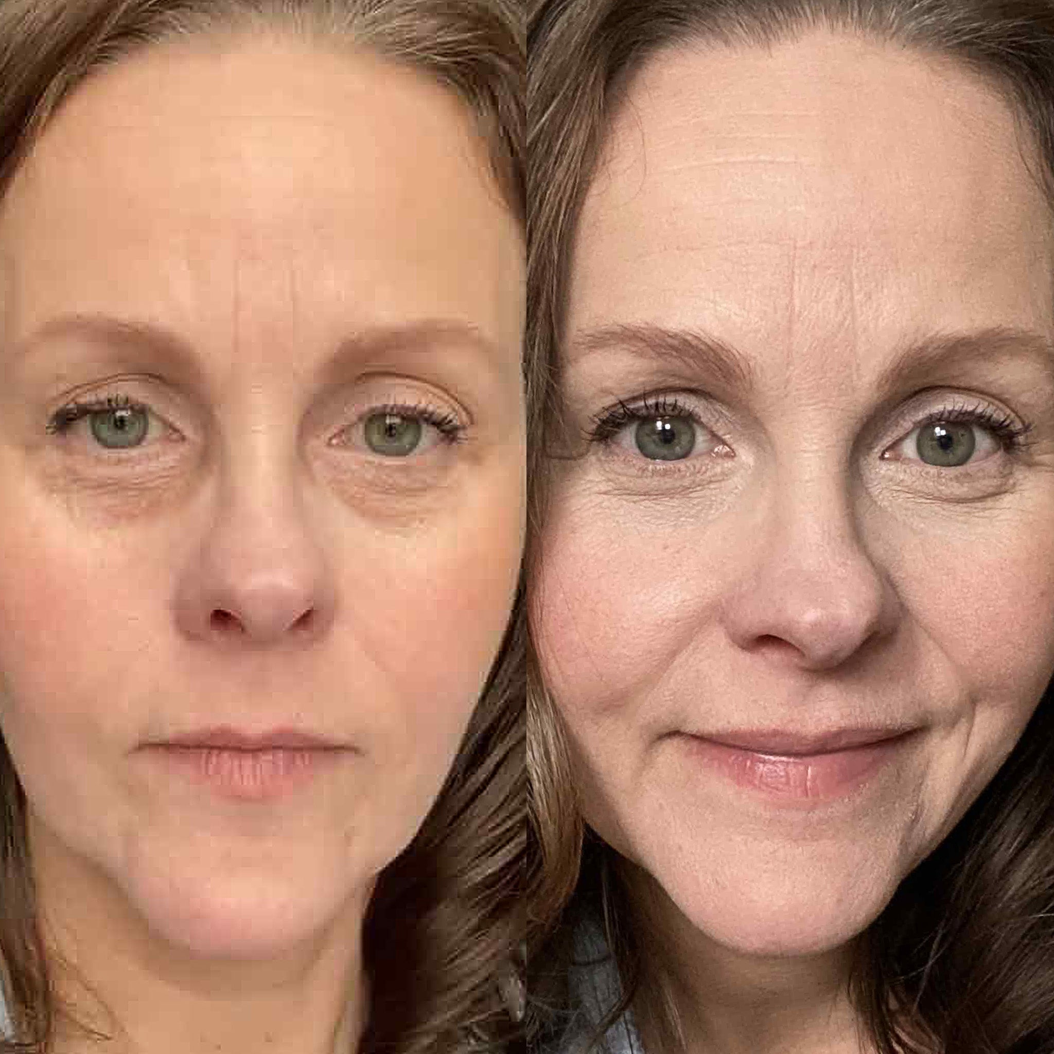 Lily Botanique Paris