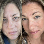 RevitalEyes® Under - Eye Red Light Therapy for Men - Botanique Paris