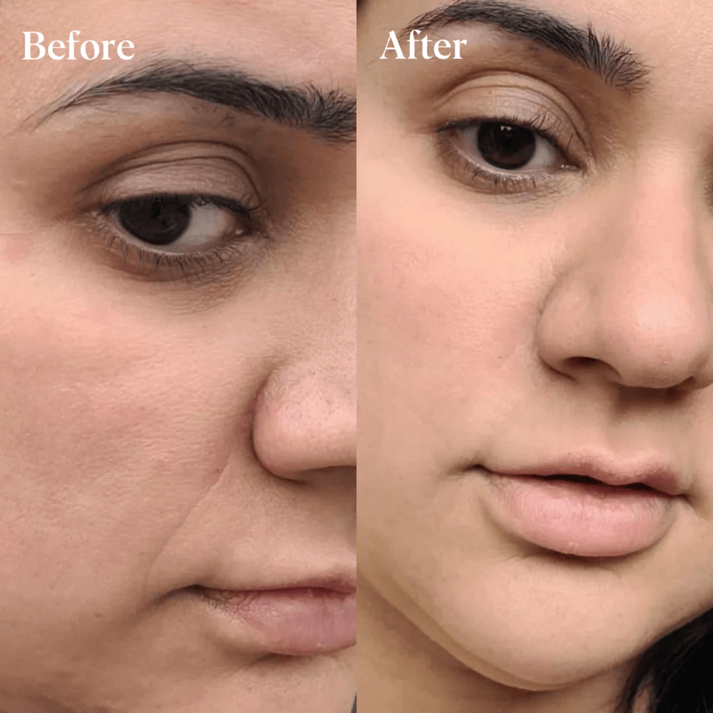 DeepCare+™ Microfusion Repair Patches - Botanique Paris