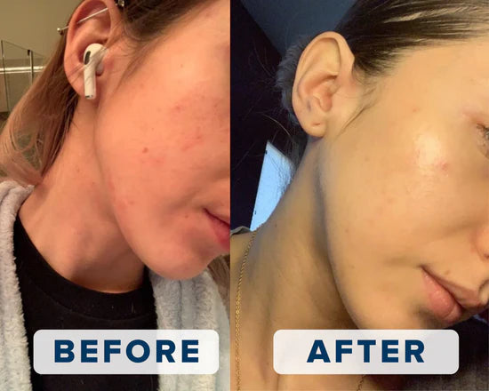 Best Skincare Investment