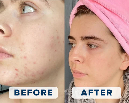 Amazing Results After Just One Use