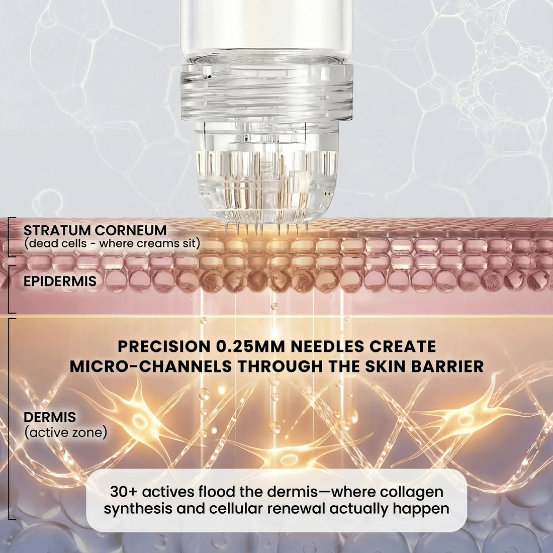 Micro-infusion delivery at 0.25mm depth