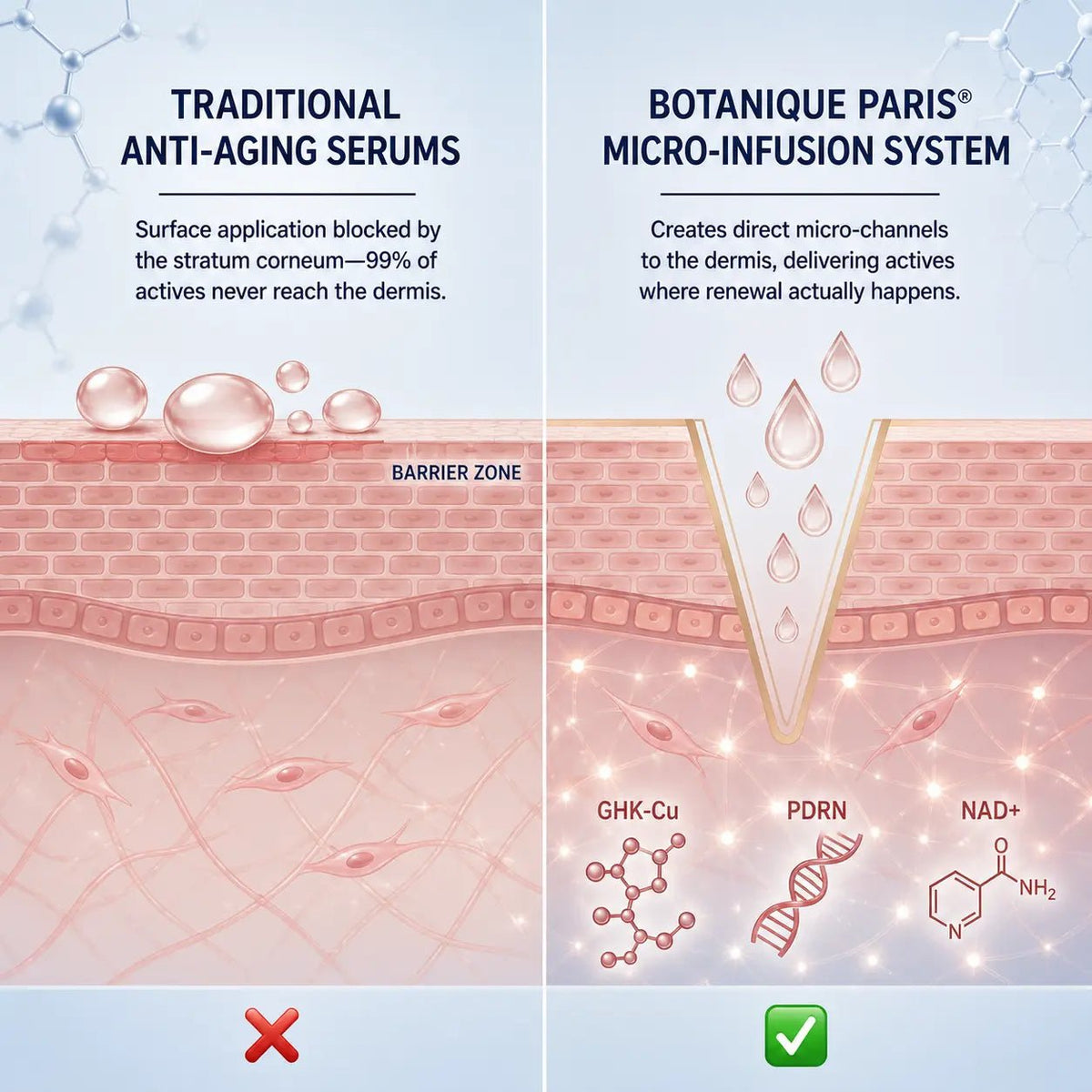 Traditional creams vs micro-infusion