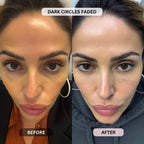 Micro - Infusion System For Under Eyes (Women) - Botanique Paris