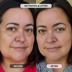 Micro - Infusion System For Under Eyes (Women) - Botanique Paris