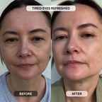 Micro - Infusion System For Under Eyes (Women) - Botanique Paris