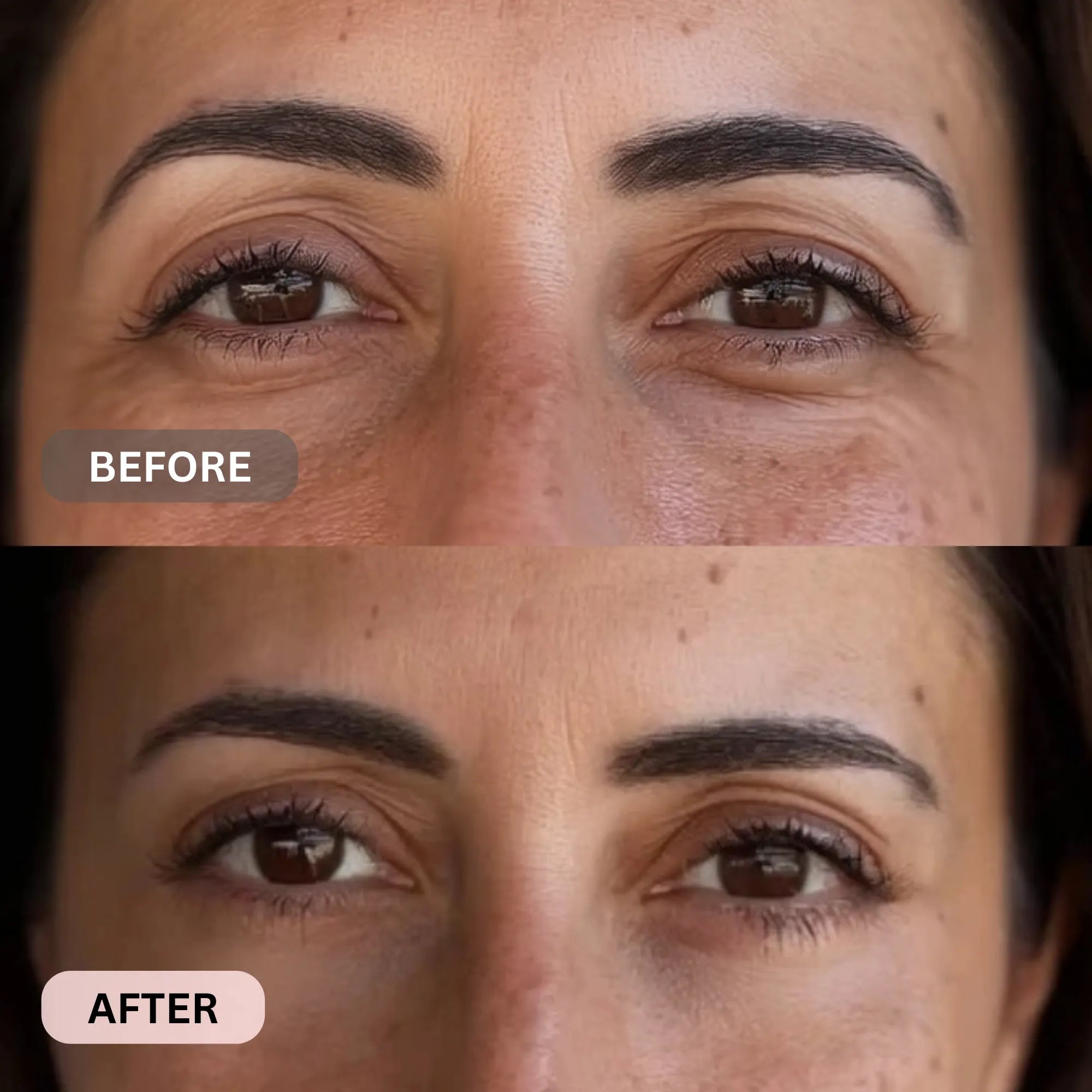Micro - Infusion System For Under Eyes (Women) - Botanique Paris