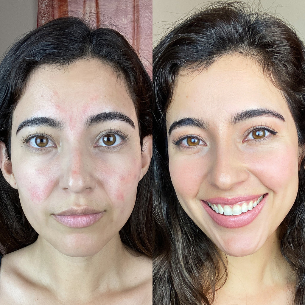 Revitalight RevitaLight™ Red Light Therapy Face Mask | Botanique Paris