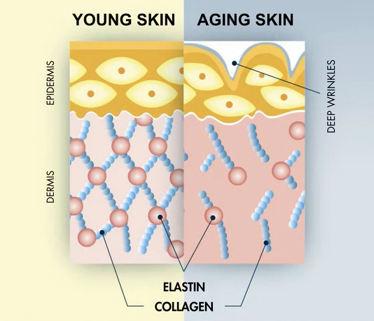 Diagram comparing young skin with aging skin, showing differences in elastin and collagen.