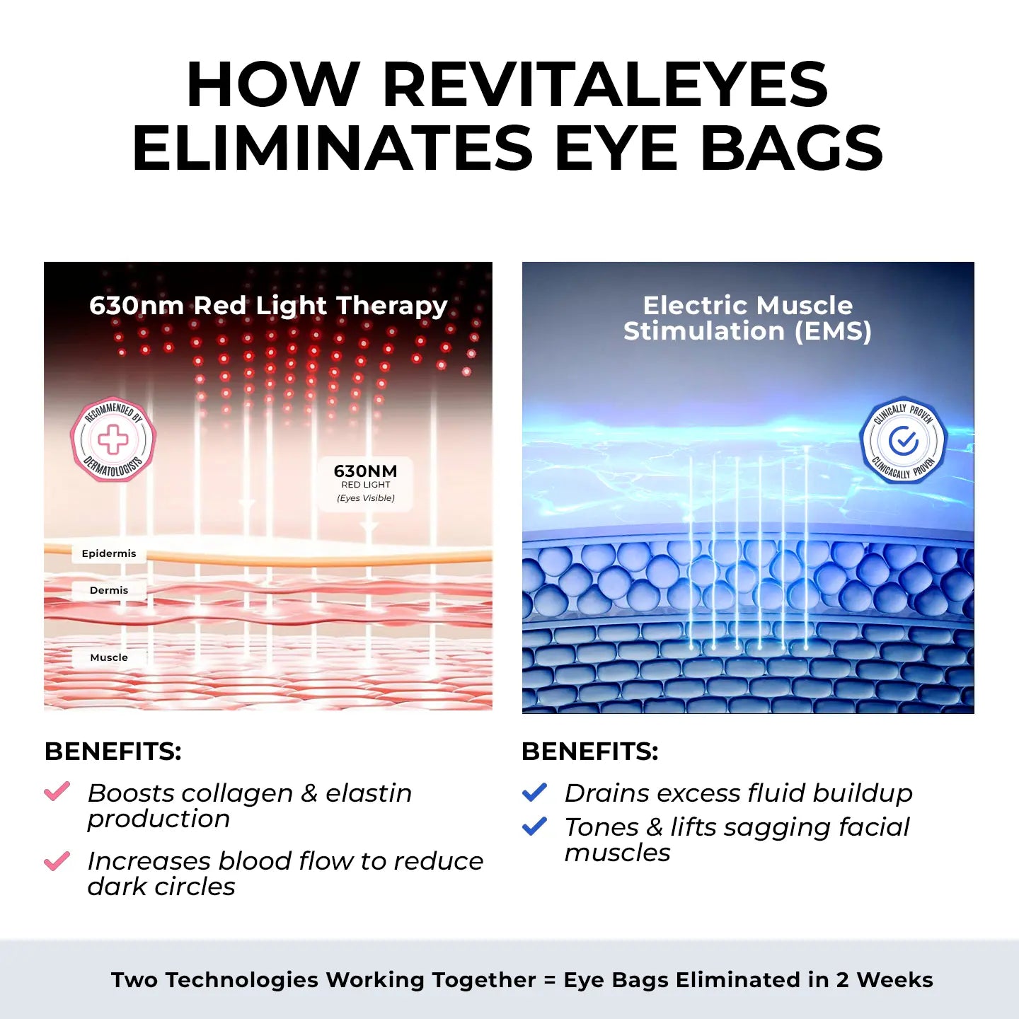 RevitalEyes® 2 - in - 1 Red Light Therapy + EMS To Erase Eye Bags - Botanique Paris