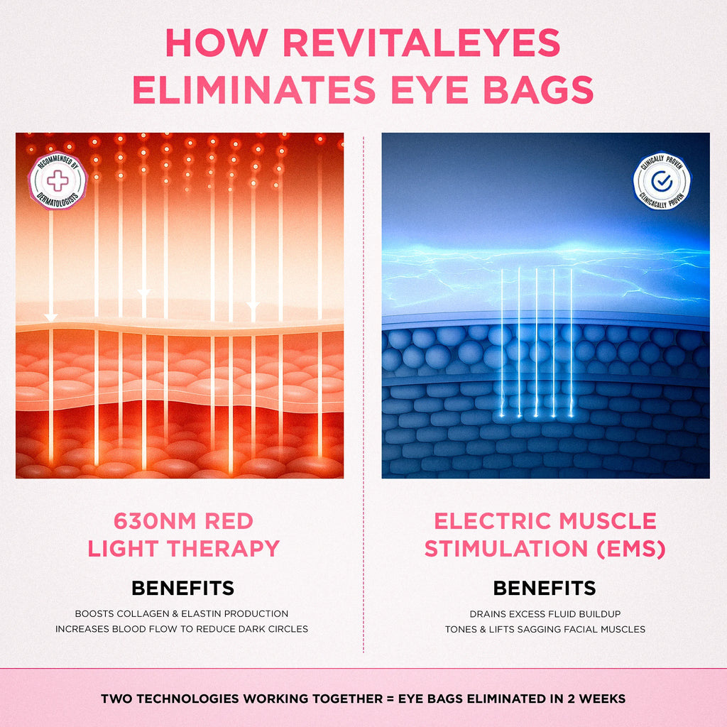 RevitalEyes® 2 - in - 1 Red Light Therapy + EMS To Erase Eye Bags - Botanique Paris
