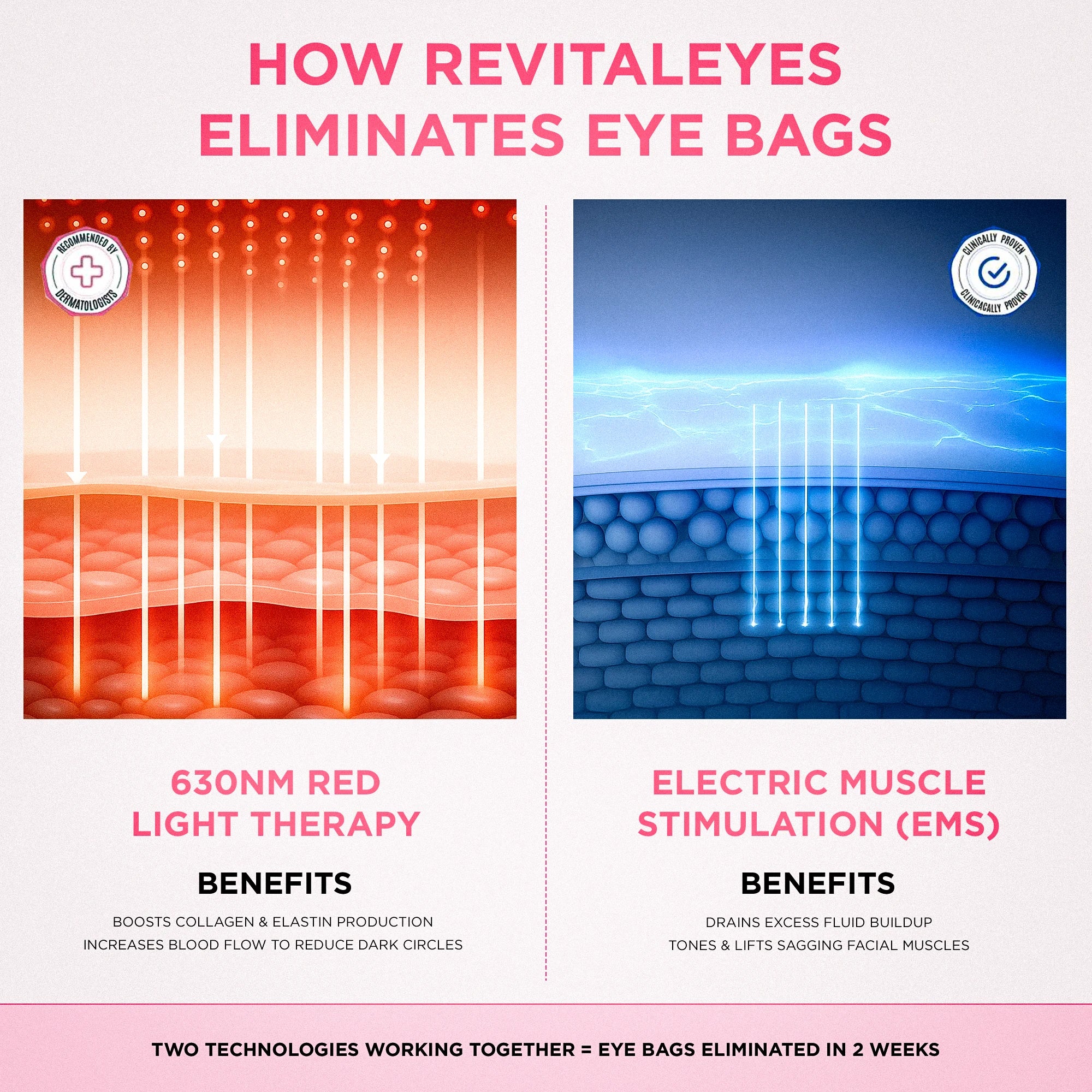 RevitalEyes® 2 - in - 1 Red Light Therapy + EMS To Erase Eye Bags - Botanique Paris