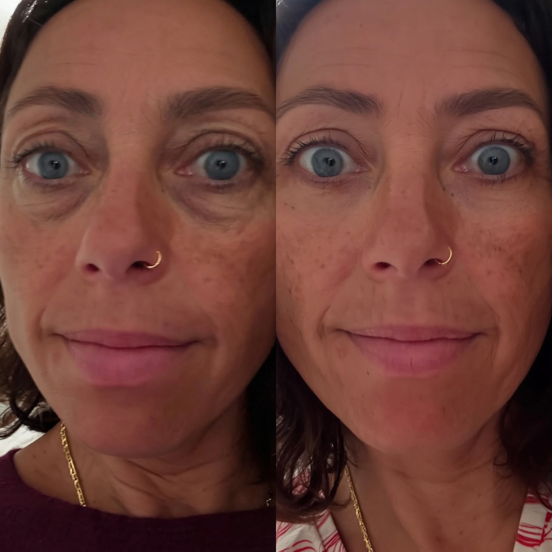 Sophia C. before and after