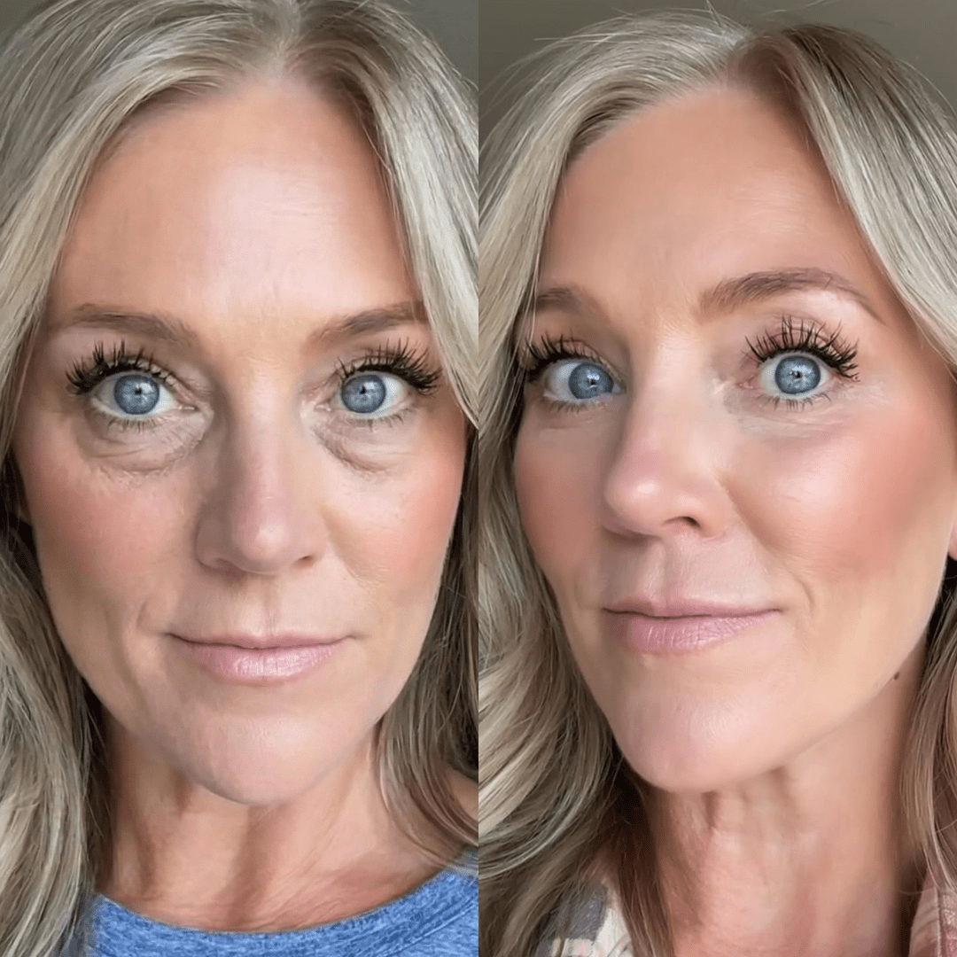 RevitalEyes® — Red Light & EMS Device for Hormone - Related Under - Eye Puffiness - Botanique Paris