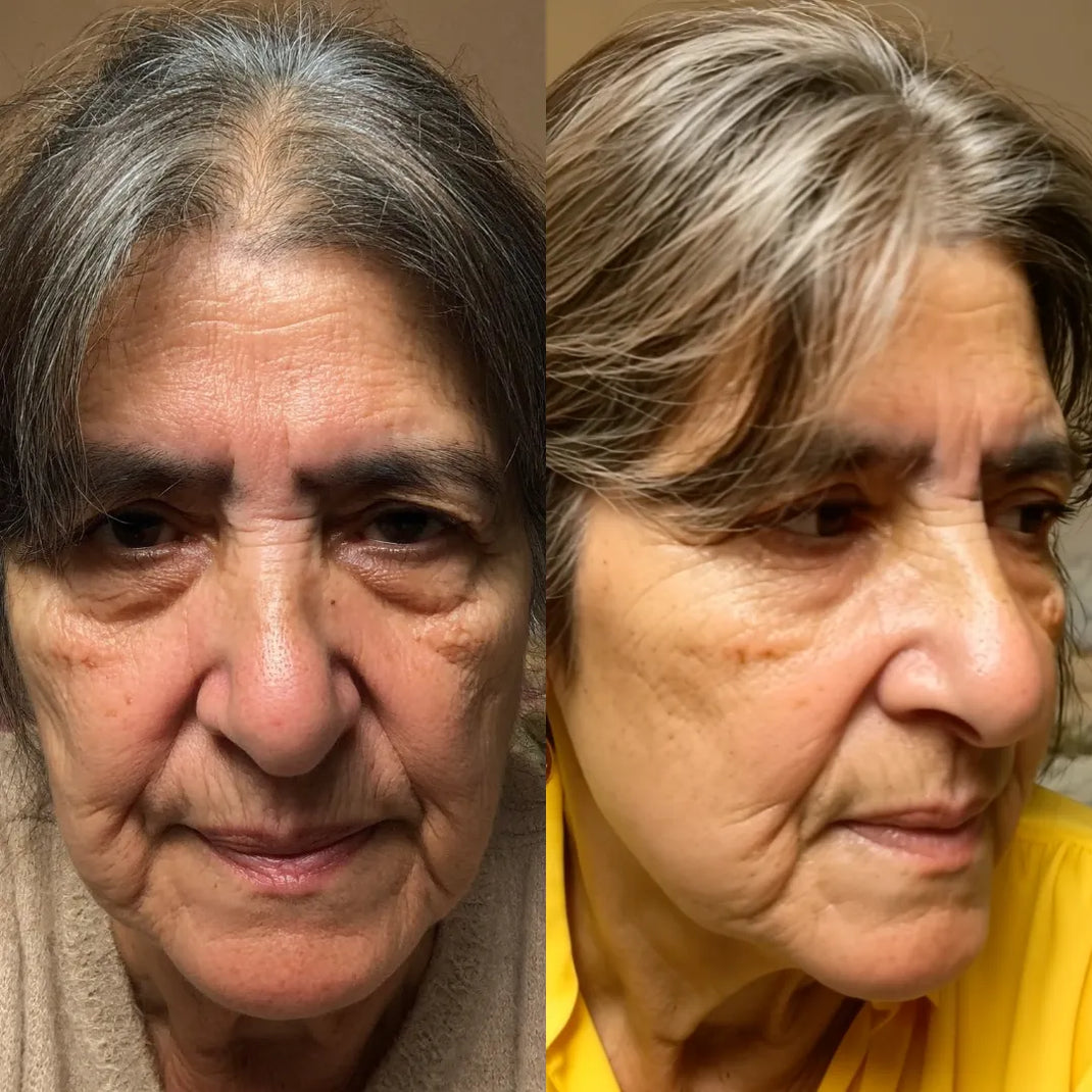 Before and After