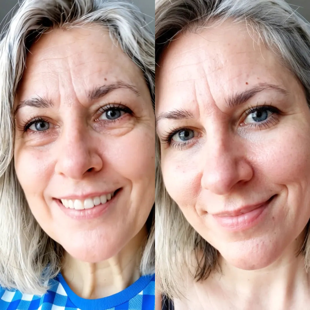 Before and After