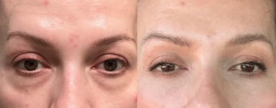 Before and after comparison of a woman's eye area with and without makeup.