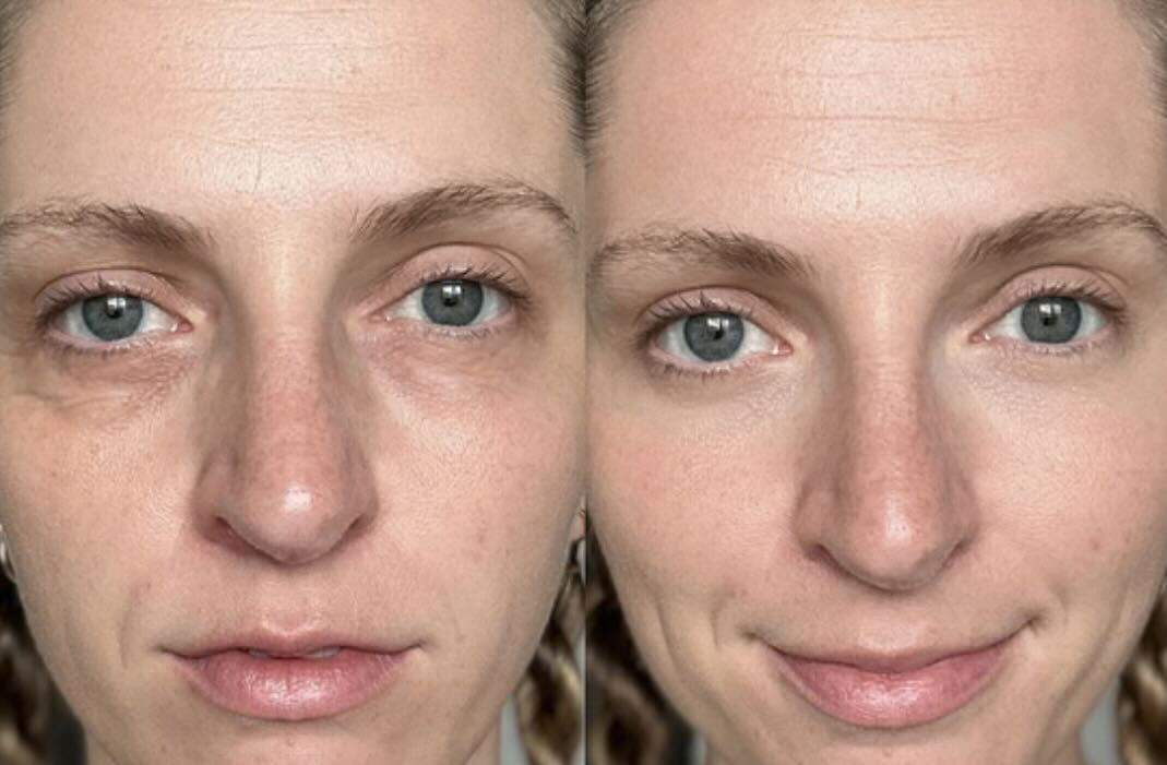 Side-by-side comparison of a woman's face with and without makeup