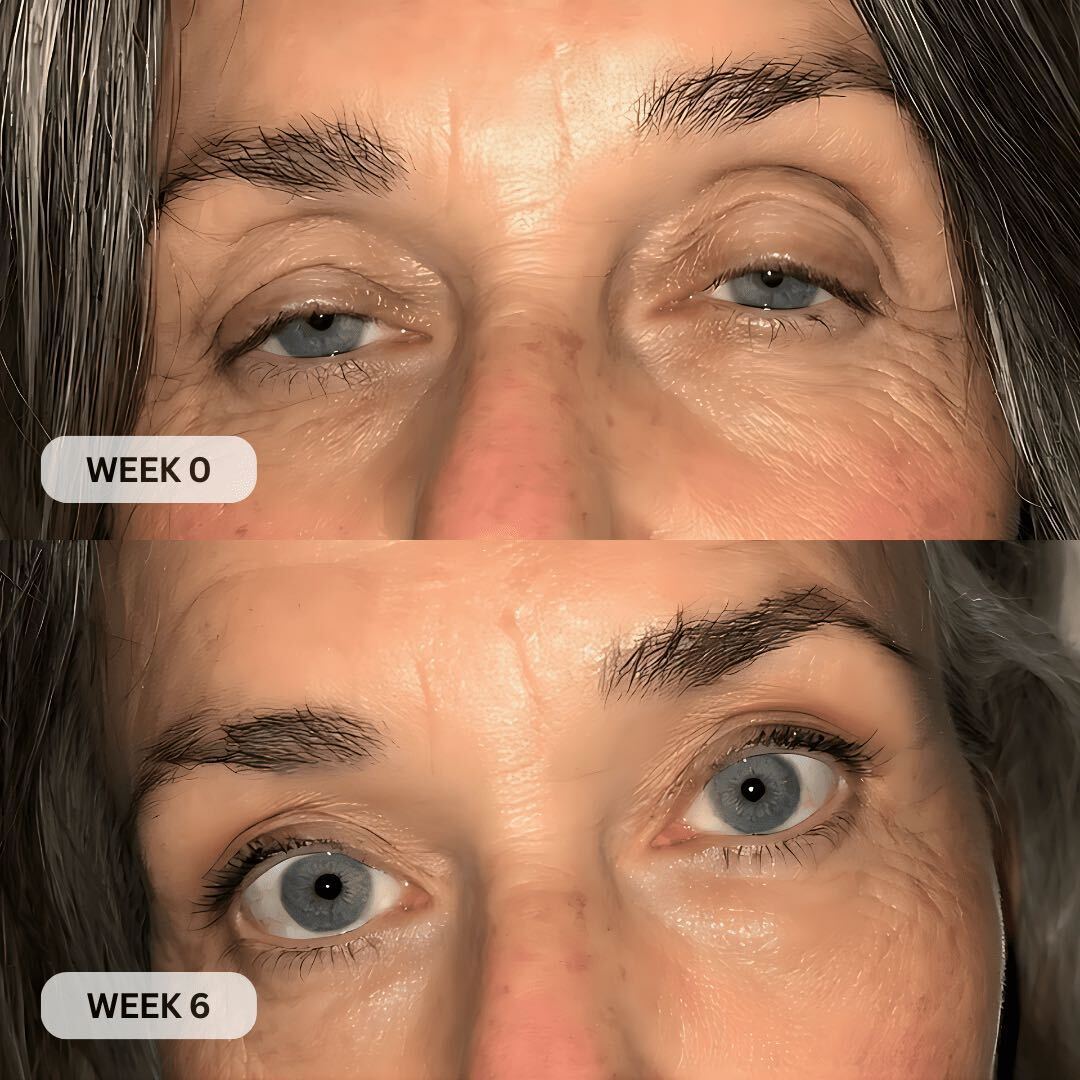 Before and after results
