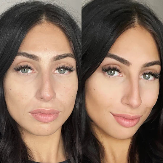 Before-and-after results of a woman's face using Botanique Paris skincare